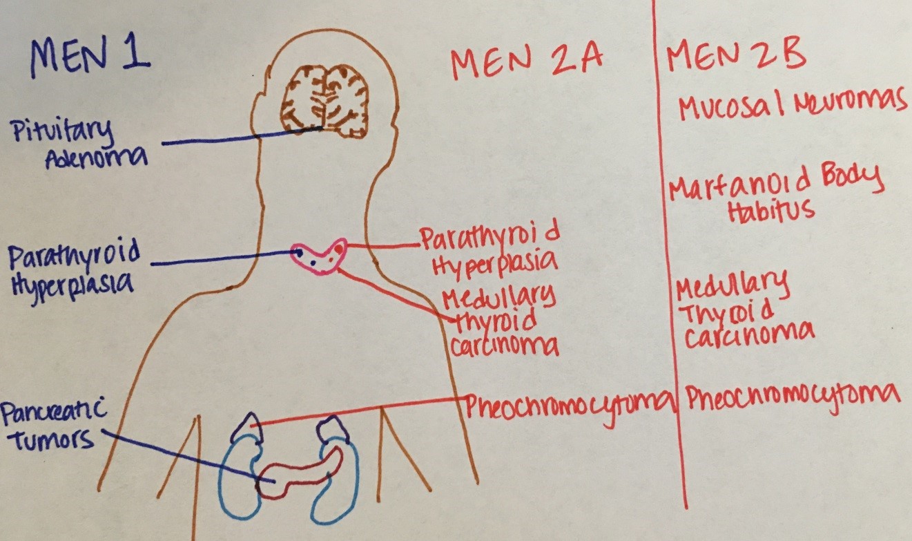 Comparison of MEN types